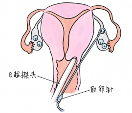 幼儿学画画，杭州捐卵宝宝学画画，学画画的好处，如何学画画