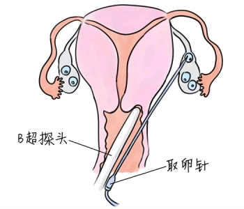 幼儿学画画，杭州捐卵宝宝学画画，学画画的好处，如何学画画